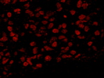 BAF53A Antibody in Immunohistochemistry (IHC)