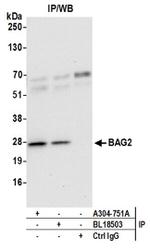 BAG2 Antibody in Western Blot (WB)