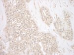 BAG3 Antibody in Immunohistochemistry (IHC)