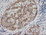 BAIAP2 Antibody in Immunohistochemistry (Paraffin) (IHC (P))