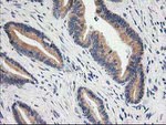 BAIAP2 Antibody in Immunohistochemistry (Paraffin) (IHC (P))