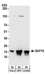 BAP18 Antibody in Western Blot (WB)