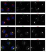 BAP31 Antibody in Immunocytochemistry (ICC/IF)