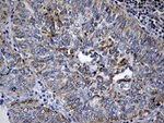 BAX Antibody in Immunohistochemistry (Paraffin) (IHC (P))