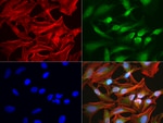 BBOX1 Antibody in Immunocytochemistry (ICC/IF)