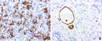 BBOX1 Antibody in Immunohistochemistry (Paraffin) (IHC (P))