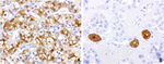 BBOX1 Antibody in Immunohistochemistry (Paraffin) (IHC (P))