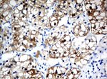 BBOX1 Antibody in Immunohistochemistry (Paraffin) (IHC (P))