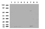 BBOX1 Antibody in Western Blot (WB)