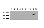 BBOX1 Antibody in Western Blot (WB)