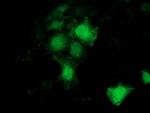 BCAR1 Antibody in Immunocytochemistry (ICC/IF)