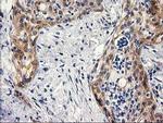 BCAR1 Antibody in Immunohistochemistry (Paraffin) (IHC (P))