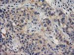 BCAR1 Antibody in Immunohistochemistry (Paraffin) (IHC (P))