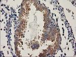 BCAR1 Antibody in Immunohistochemistry (Paraffin) (IHC (P))