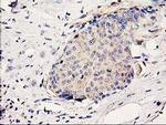 BCAR1 Antibody in Immunohistochemistry (Paraffin) (IHC (P))