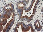 BCAR1 Antibody in Immunohistochemistry (Paraffin) (IHC (P))