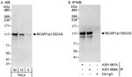BCAR1/p130CAS Antibody in Western Blot (WB)