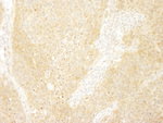 BCAR1/p130CAS Antibody in Immunohistochemistry (IHC)