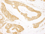 BCAR1/p130CAS Antibody in Immunohistochemistry (IHC)