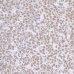 BCAS2 Antibody in Immunohistochemistry (IHC)