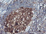 BCAT1 Antibody in Immunohistochemistry (Paraffin) (IHC (P))