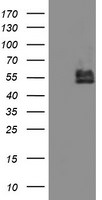 BCAT1 Antibody in Western Blot (WB)