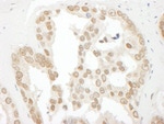 BCCIP Antibody in Immunohistochemistry (IHC)