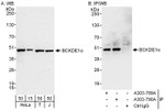 BCKDE1A Antibody in Western Blot (WB)