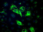 BCKDK Antibody in Immunocytochemistry (ICC/IF)