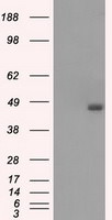 BCKDK Antibody in Western Blot (WB)