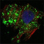 Bcl-10 Antibody in Immunocytochemistry (ICC/IF)