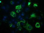 BCL10 Antibody in Immunocytochemistry (ICC/IF)