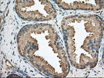 BCL10 Antibody in Immunohistochemistry (Paraffin) (IHC (P))