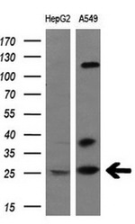 BCL10 Antibody in Western Blot (WB)