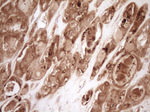 BCL2 Antibody in Immunohistochemistry (Paraffin) (IHC (P))