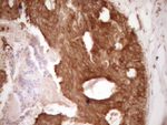 BCL2 Antibody in Immunohistochemistry (Paraffin) (IHC (P))