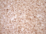 BCL2 Antibody in Immunohistochemistry (Paraffin) (IHC (P))