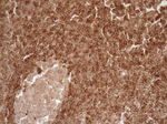 BCL2 Antibody in Immunohistochemistry (Paraffin) (IHC (P))