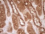 BCL2 Antibody in Immunohistochemistry (Paraffin) (IHC (P))