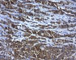 BCL2 Antibody in Immunohistochemistry (Paraffin) (IHC (P))