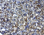 BCL2 Antibody in Immunohistochemistry (Paraffin) (IHC (P))