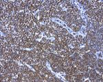 BCL2 Antibody in Immunohistochemistry (Paraffin) (IHC (P))