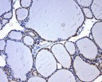 BCL2 Antibody in Immunohistochemistry (Paraffin) (IHC (P))