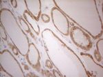 BCL2 Antibody in Immunohistochemistry (Paraffin) (IHC (P))