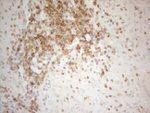 BCL2 Antibody in Immunohistochemistry (Paraffin) (IHC (P))