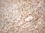 BCL2 Antibody in Immunohistochemistry (Paraffin) (IHC (P))