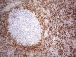 BCL2 Antibody in Immunohistochemistry (Paraffin) (IHC (P))