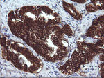 BCL2L1 Antibody in Immunohistochemistry (Paraffin) (IHC (P))