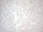 BCL2L14 Antibody in Immunohistochemistry (Paraffin) (IHC (P))