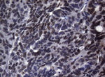 BCL6 Antibody in Immunohistochemistry (Paraffin) (IHC (P))